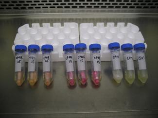Ecoli-in-MHB-Oct-15-2020-768x575.jpeg Ecoli-in-MHB-Oct-15-2020-768x575.jpeg